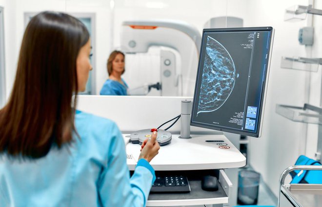 Mamografija in ultrazvok večinoma ne pokažeta zametkov lobularnega karcinoma, dokler ni ta že izredno razširjen. Sploh pri ženskah z gostim tkivom dojk se ta vrsta raka na posnetkih dobro skriva. Foto: Shutterstock