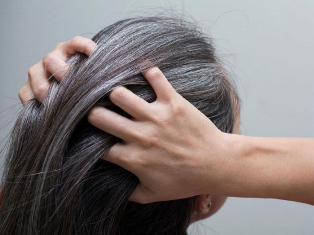 Kaj povzroča sivenje las?